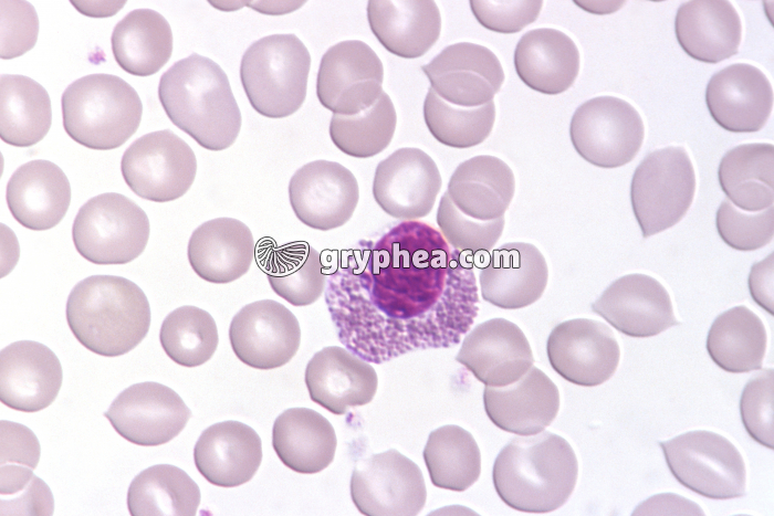 Granulocyte éosinophile x 400 - gryphea.com